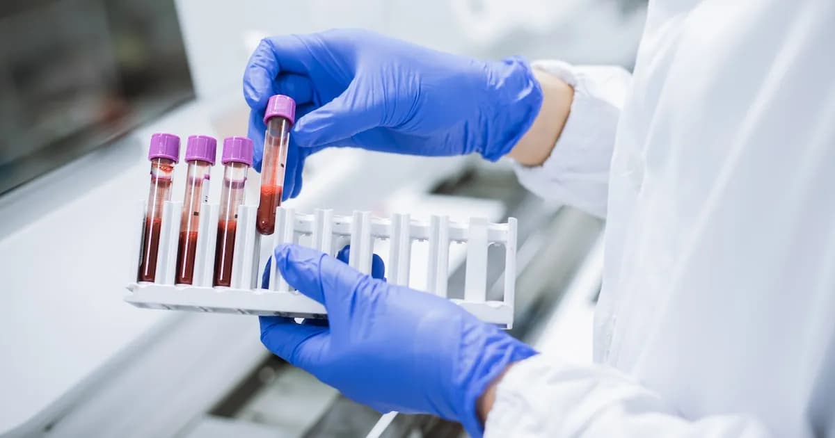 El descubrimiento del factor RH negativo en México y su vínculo con la conquista española