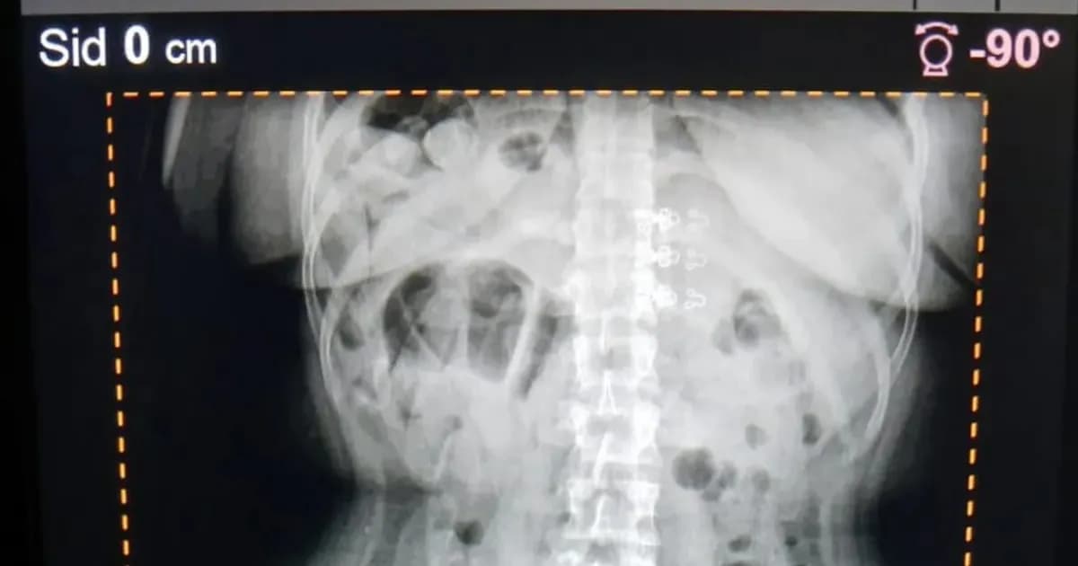 Tres mujeres arrestadas con más de dos kilos de cocaína en el cuerpo en Tucumán