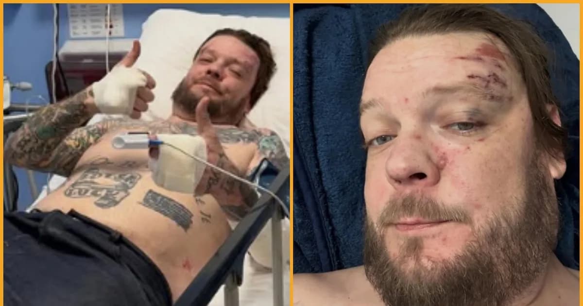 Corey Harrison, protagonista de 'El precio de la historia', busca ayuda tras accidente en Tulum