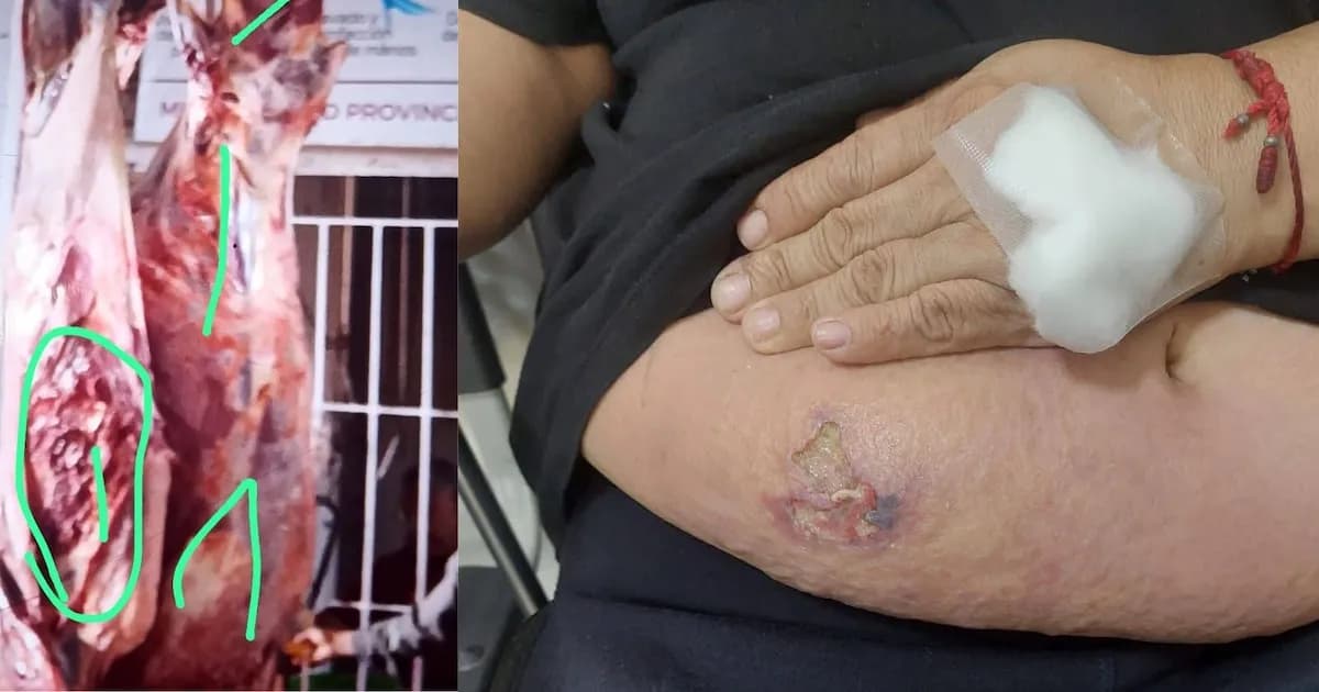 Ica: Se descarta caso de carbunco tras análisis de salud pública