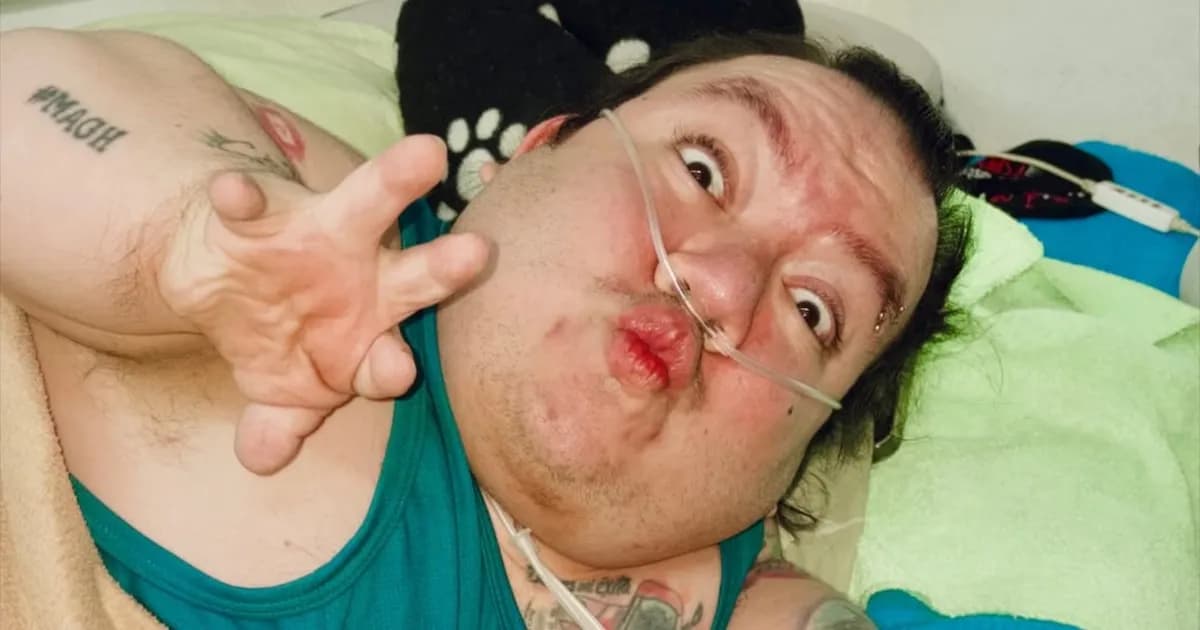 Falleció el influencer colombiano Alejo Little a los 33 años: su legado y lucha inspiradora