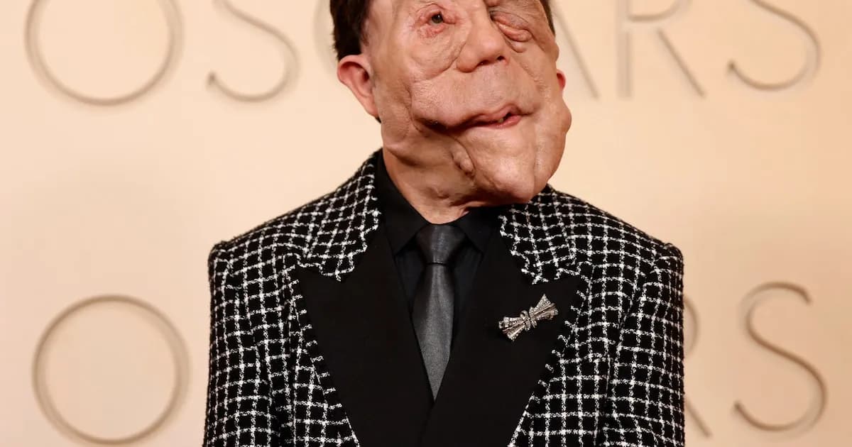 Premios Oscar 2026: Adam Pearson y la lucha contra la neurofibromatosis