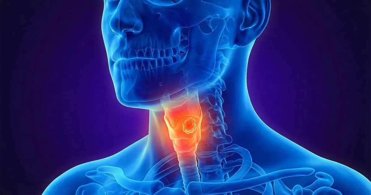 Vibraciones mecánicas: una nueva esperanza en la lucha contra el cáncer de laringe