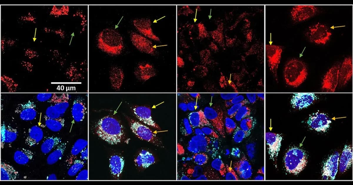 Innovador enfoque en la lucha contra el cáncer reduce quimioterapia y aumenta eficacia