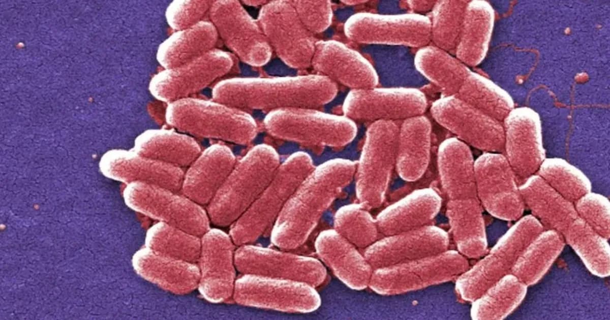 Alerta sanitaria en EE.UU.: brote de E. coli vinculado a quesos Raw Farm