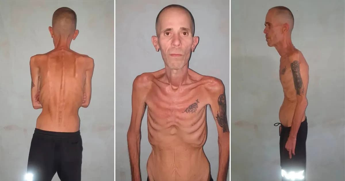 Liberación de un preso político cubano expone la cruda realidad del régimen