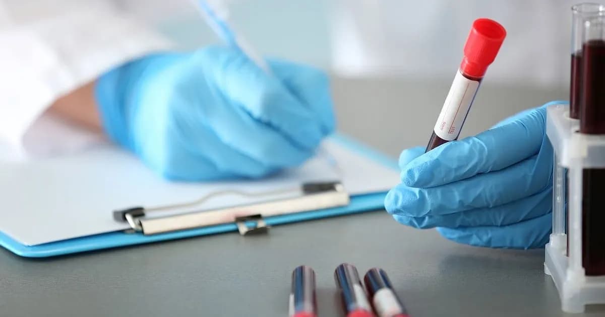 La mayoría de las personas se haría un análisis de sangre para detectar Alzheimer