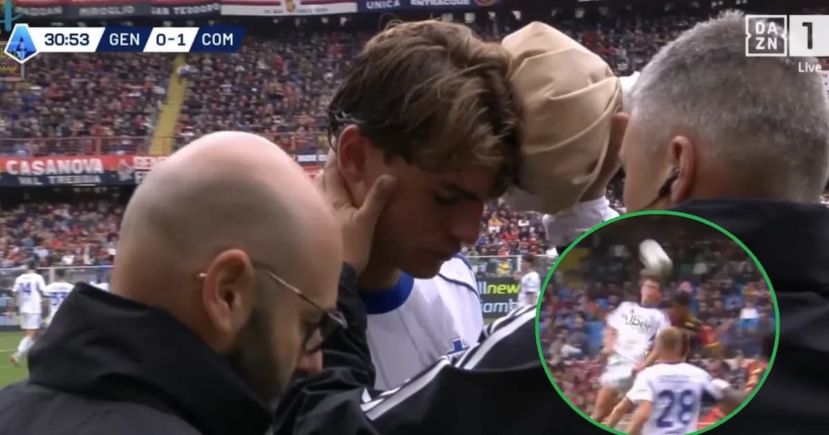 Nicolás Paz hospitalizado tras un golpe en la cabeza durante el partido de Como