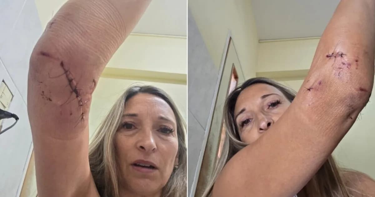 Bahía Blanca: mujer atacada por dogos argentinos relata su traumática experiencia