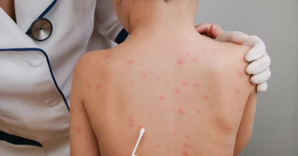 Actualización en el Sistema de Vigilancia Sanitaria: Nuevas Enfermedades y Protocolos