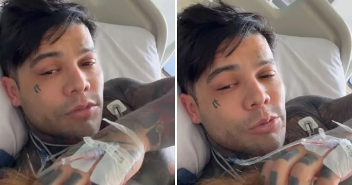 Yeferson Cossio comparte su diagnóstico de alopecia areata y su enfoque alternativo