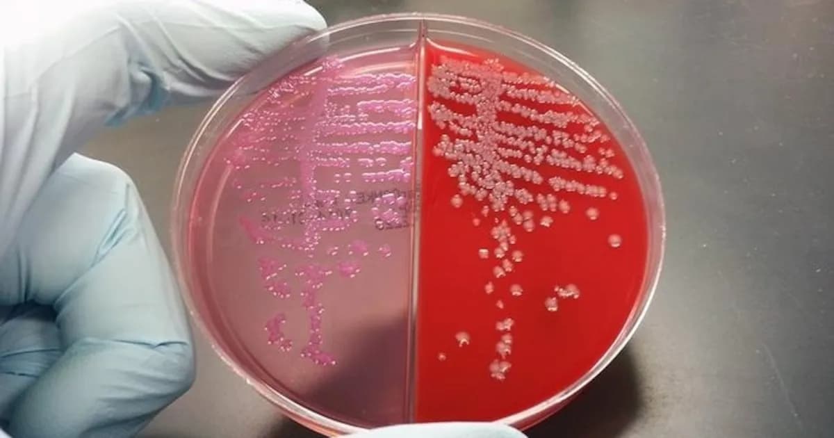 Descubren virus en bacterias intestinales que podría relacionarse con el cáncer de colon