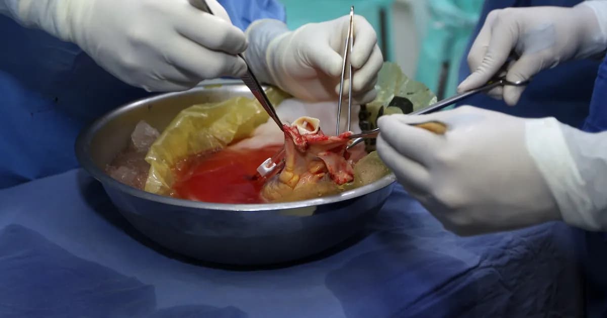 Revolución en el acceso a trasplantes en México: nuevo plan del IMSS