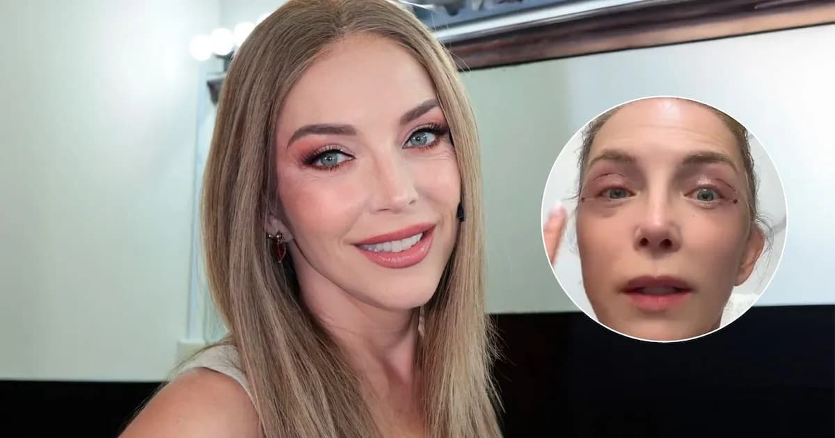 Laura Flores comparte su experiencia con la blefaroplastia en redes sociales