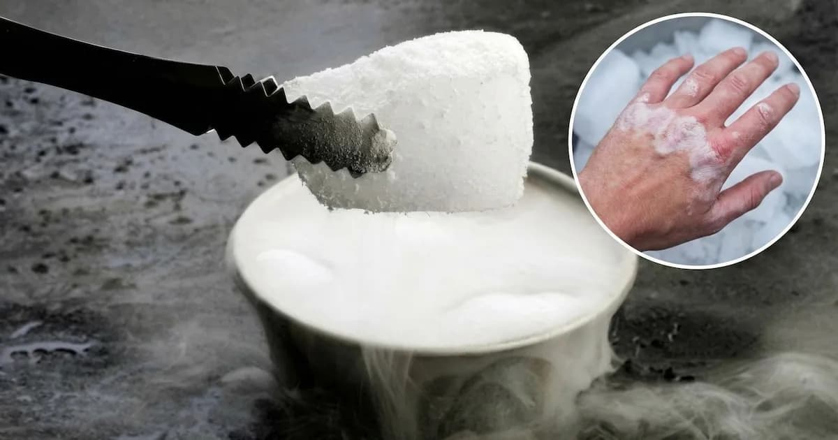 Precauciones ante quemaduras por hielo seco: cómo actuar y prevenir complicaciones
