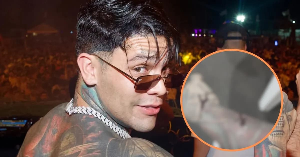 Yeferson Cossio deberá operarse tras sufrir un accidente que afectó su brazo