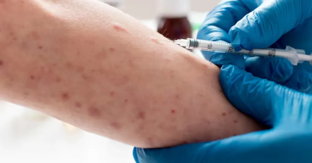 México registra más de 12 mil casos de sarampión y 34 muertes confirmadas