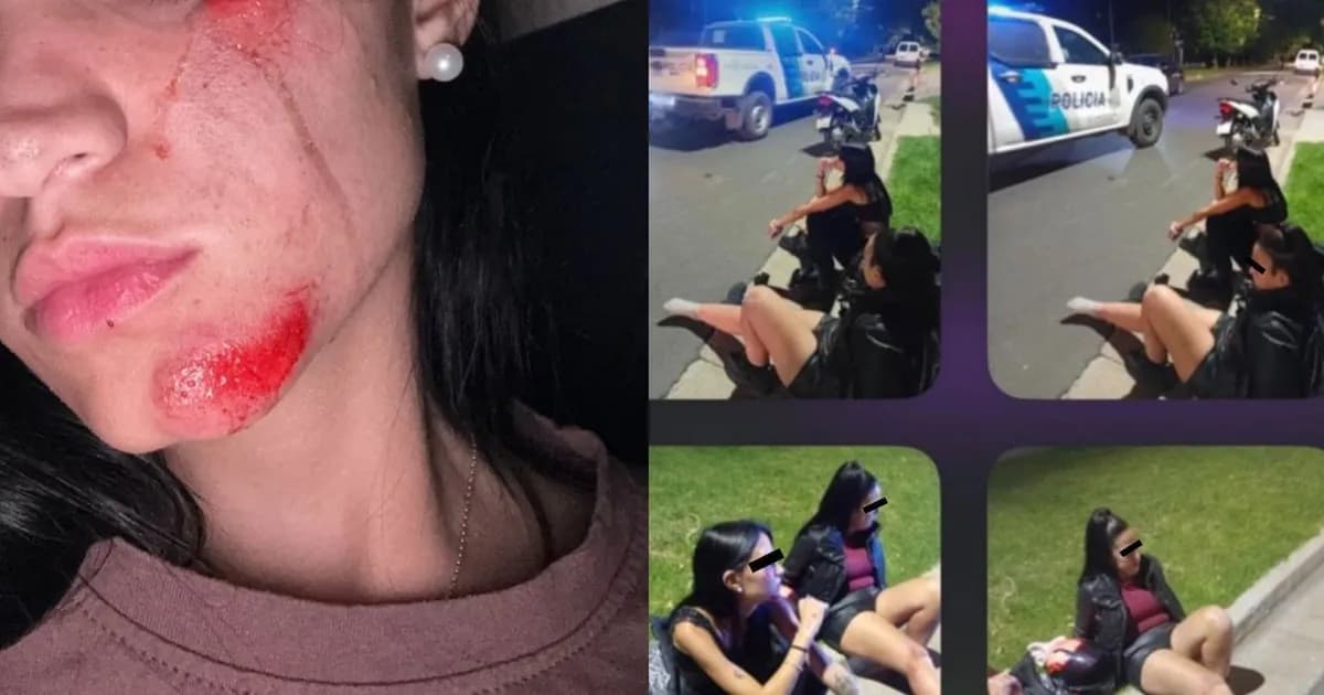 Buscan al responsable de un choque que dejó dos mujeres heridas en La Plata