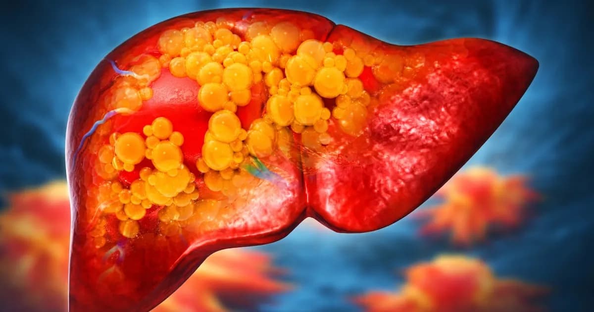 El consumo mensual excesivo de alcohol eleva el riesgo de enfermedades hepáticas graves