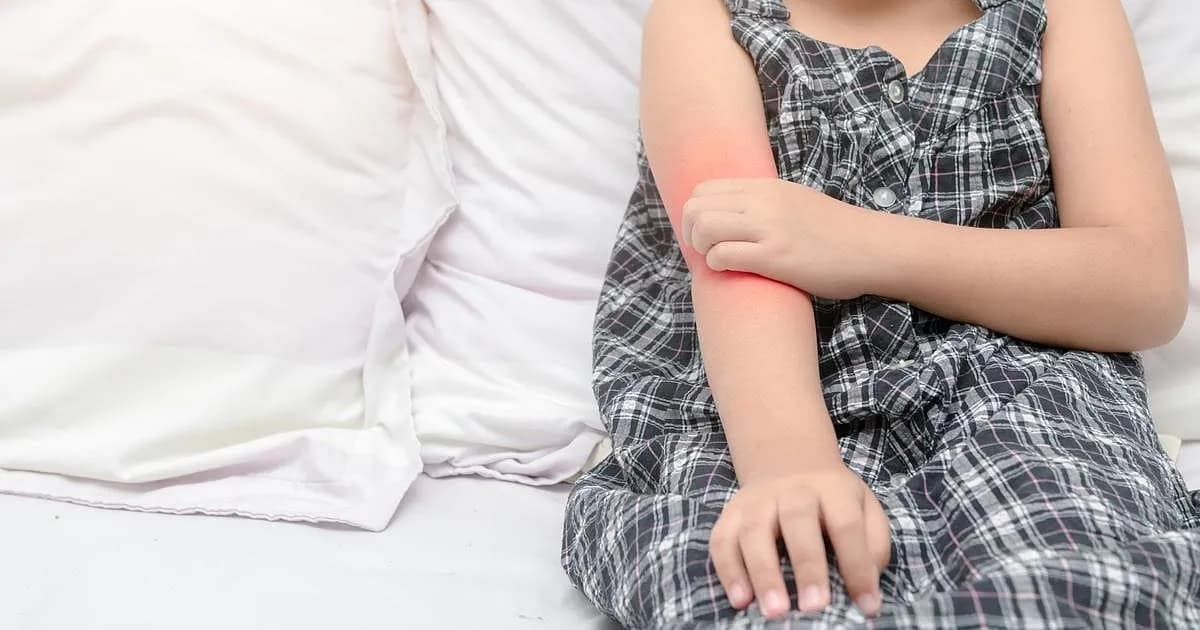 Opciones de tratamiento para el eccema infantil: nuevas guías de la dermatología