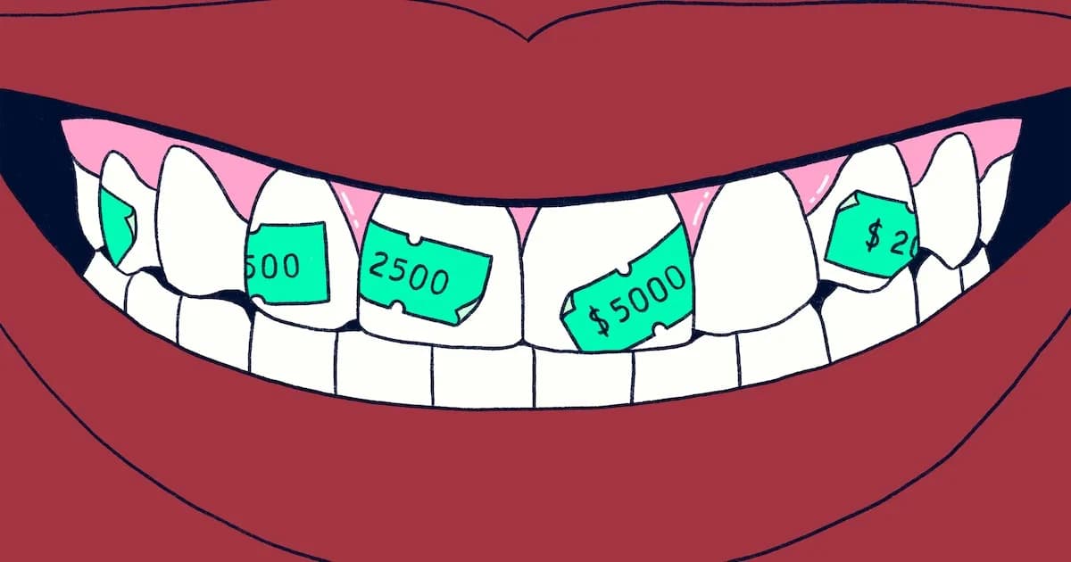 ¿Es necesario siempre un empaste? Lo que debes saber sobre las caries dentales