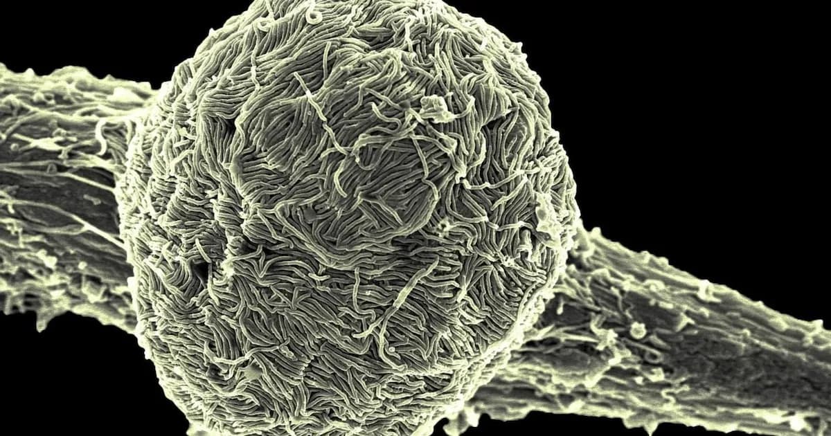 El brote de ébola en RDC suma más de 670 casos sospechosos y 160 muertes potenciales