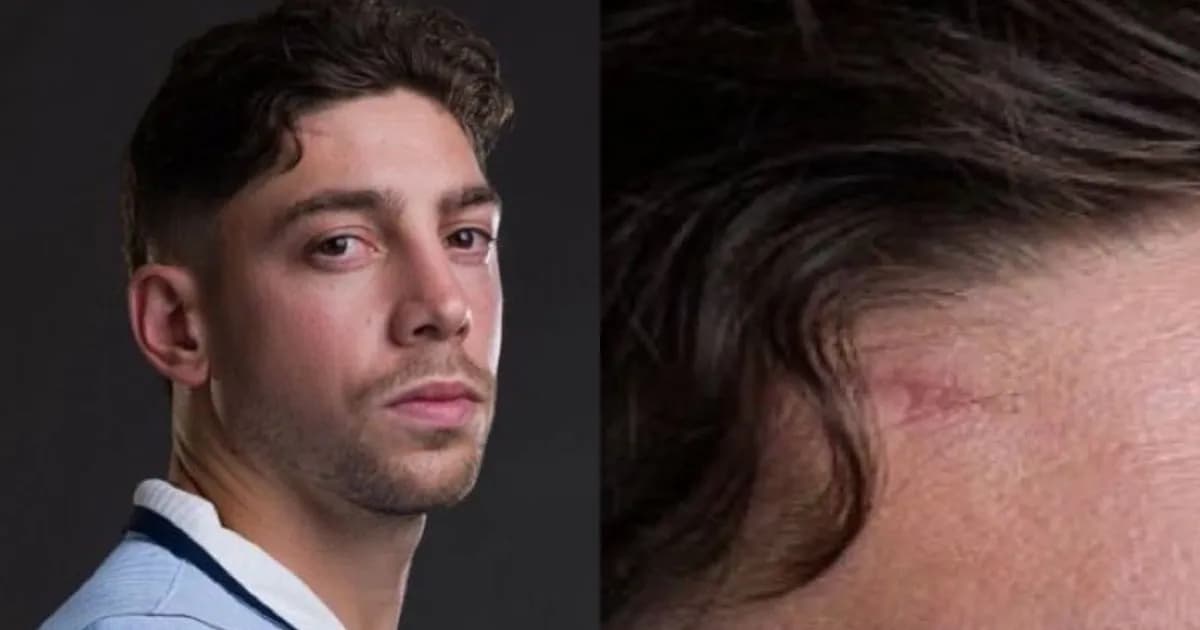 La cicatriz de Federico Valverde: un detalle que impacta en la previa del Mundial 2026