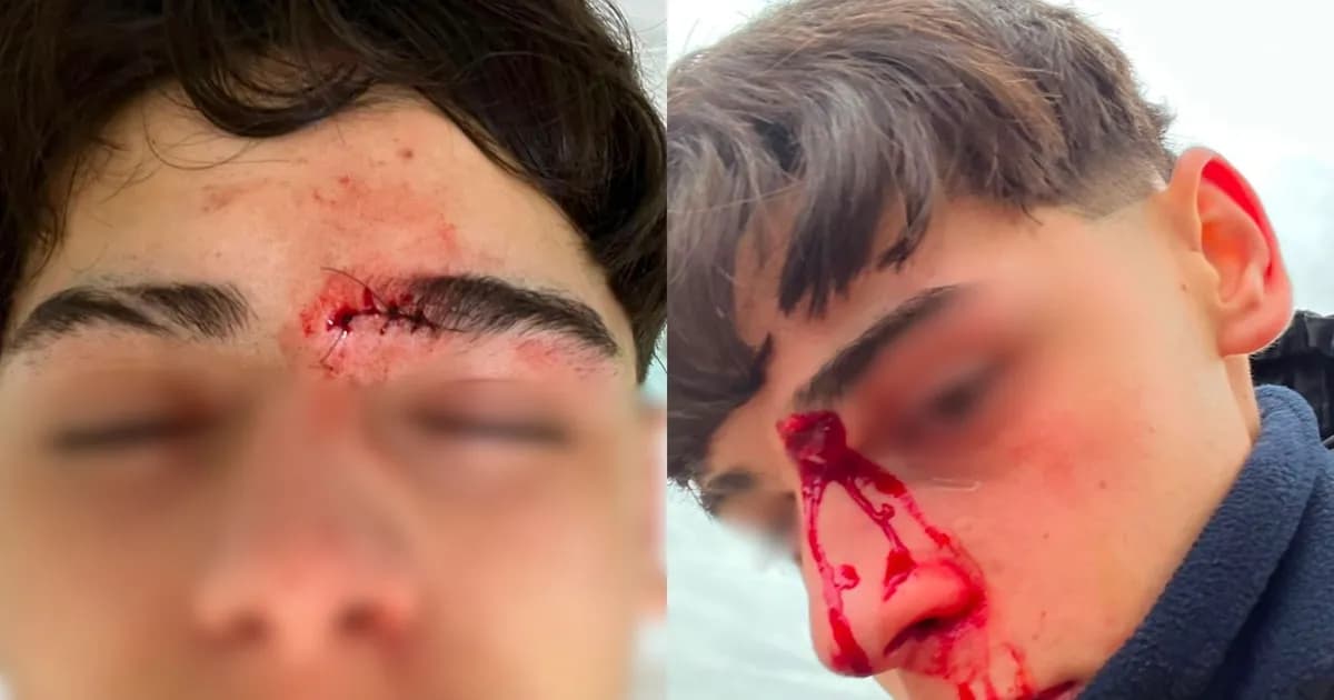 Violencia en el fútbol infantil: jugadores de Bella Vista agredidos tras un partido