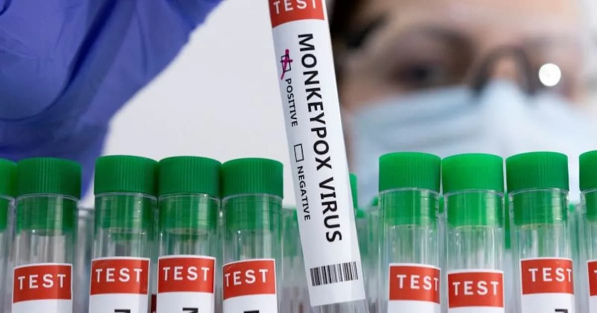 Costa Rica: Dos casos de Viruela del Mono se mantienen estables y sin vínculos epidemiológicos