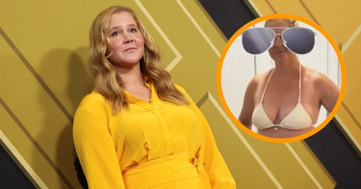 Amy Schumer muestra su cicatriz de cesárea y celebra su fortaleza en Instagram
