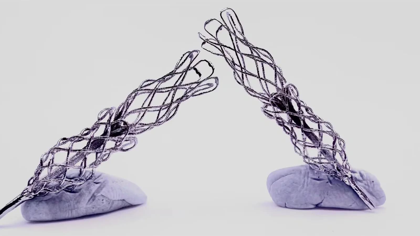 NitiBraid, el implante vascular personalizado que ganó el James Dyson Award nacional