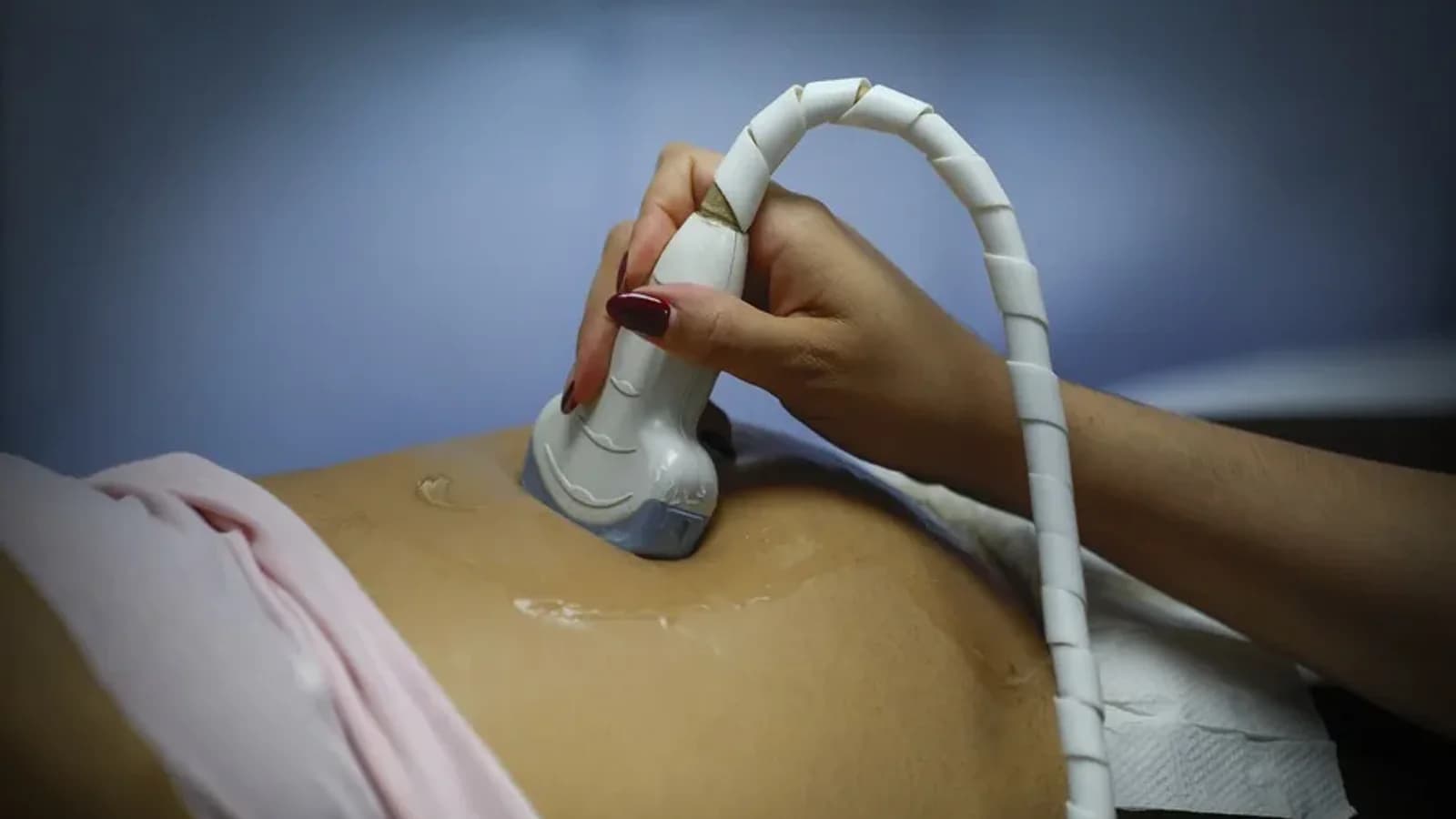 Proyecto de ley en Chile obliga a escuchar latidos del feto antes de un aborto