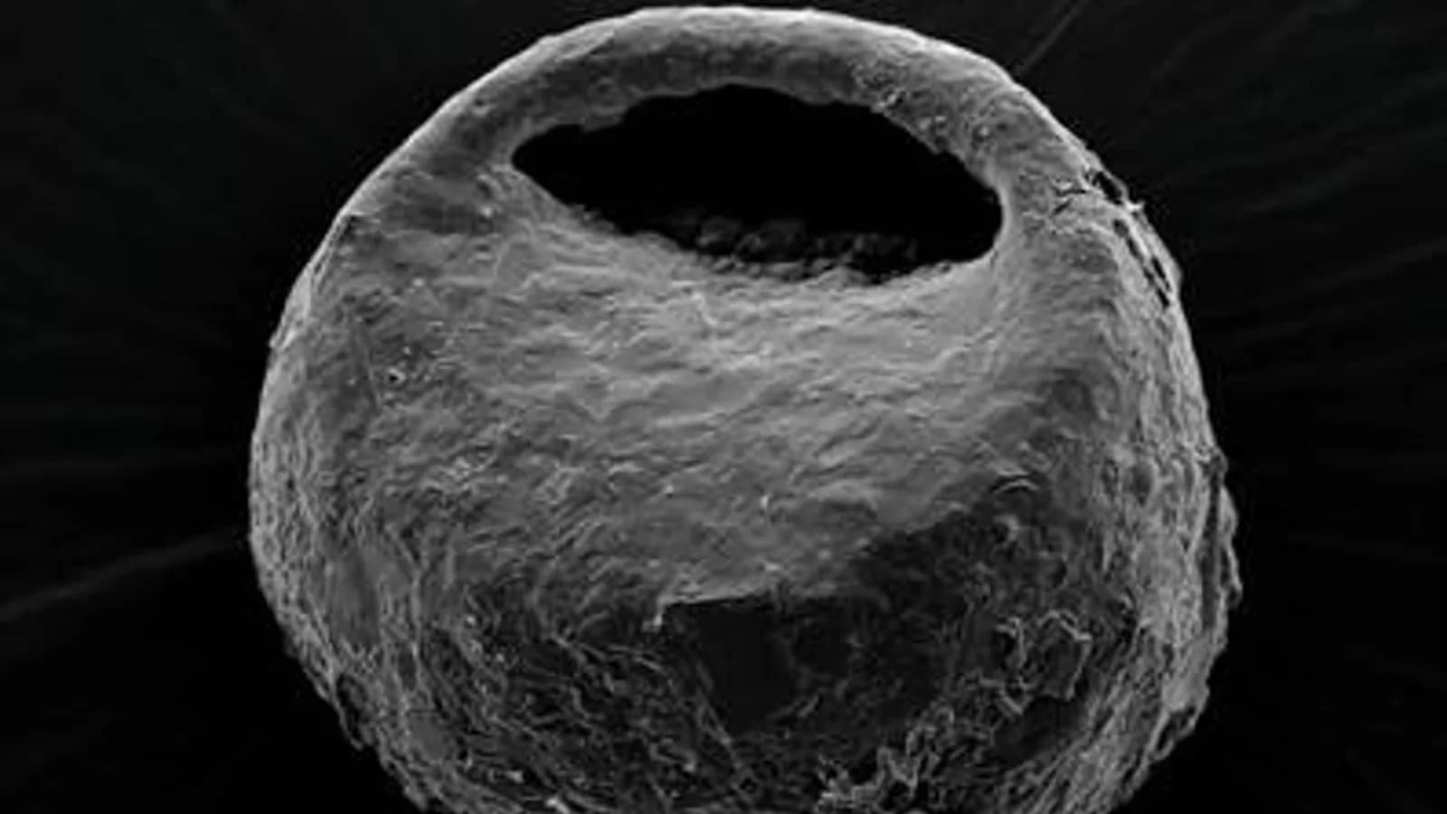 Las glaciaciones del Cuaternario dejaron huella en las amebas ibéricas