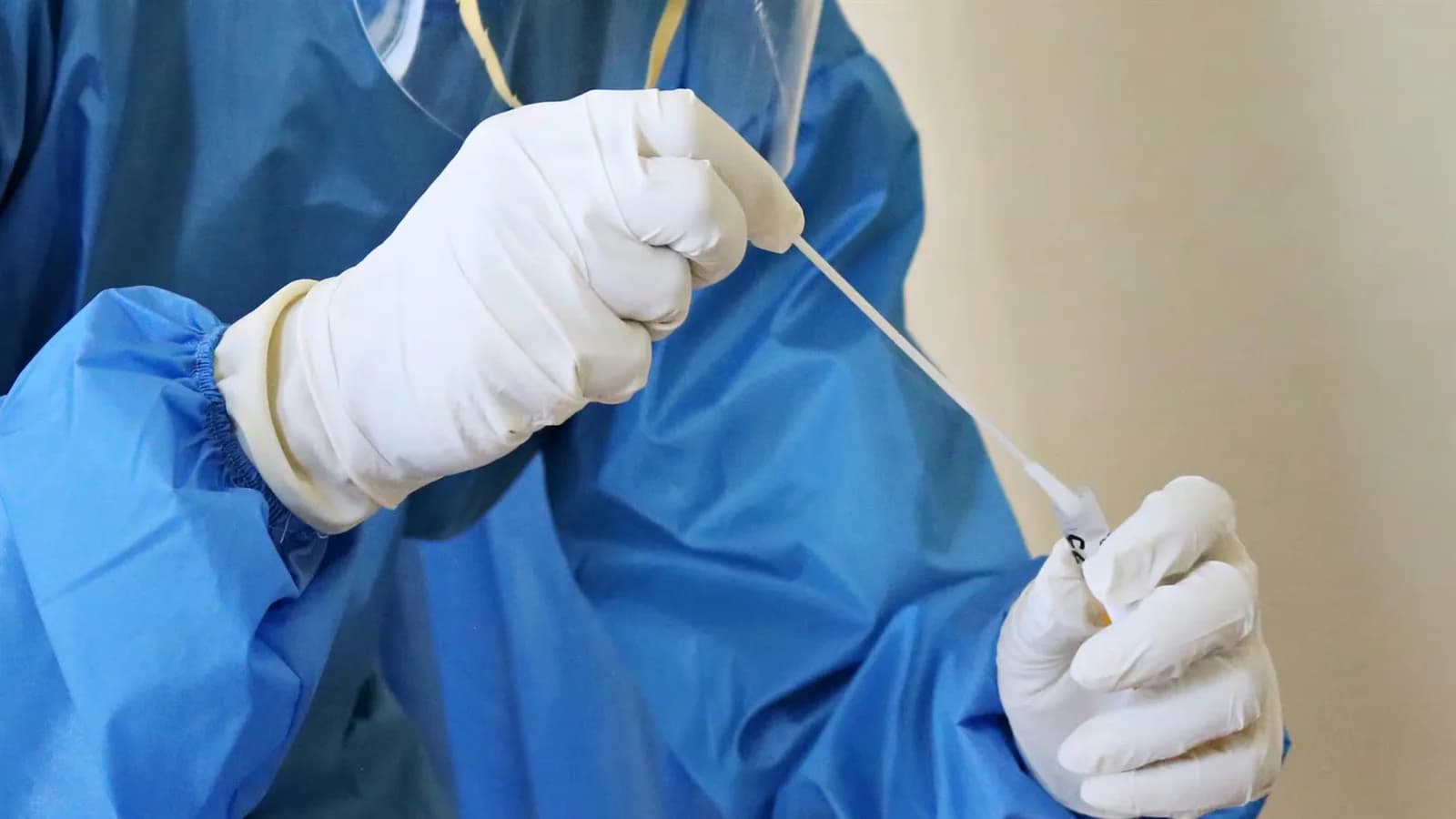Un paciente franco-argentino con hantavirus permanece aislado en Galicia