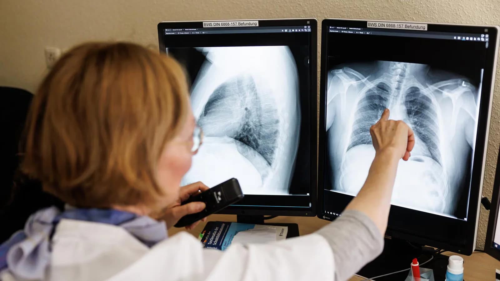 Confirman dos casos de tuberculosis en una explotación de Segovia: un trabajador murió