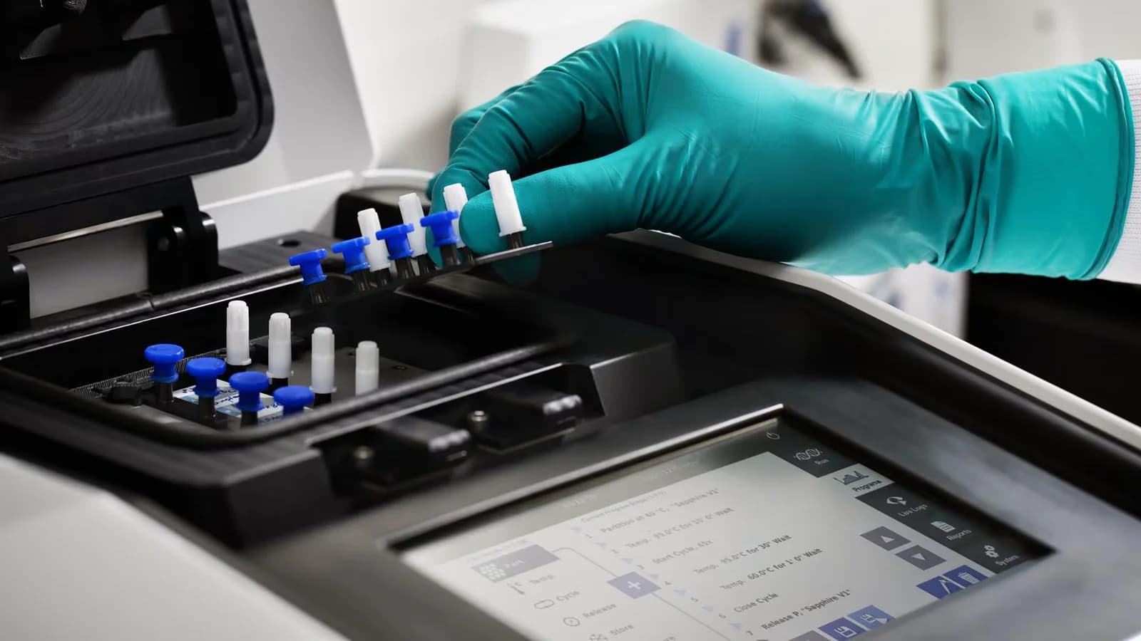 La Unión Europea destina 2,1 millones de euros a pruebas PCR para el brote de ébola en la RDC
